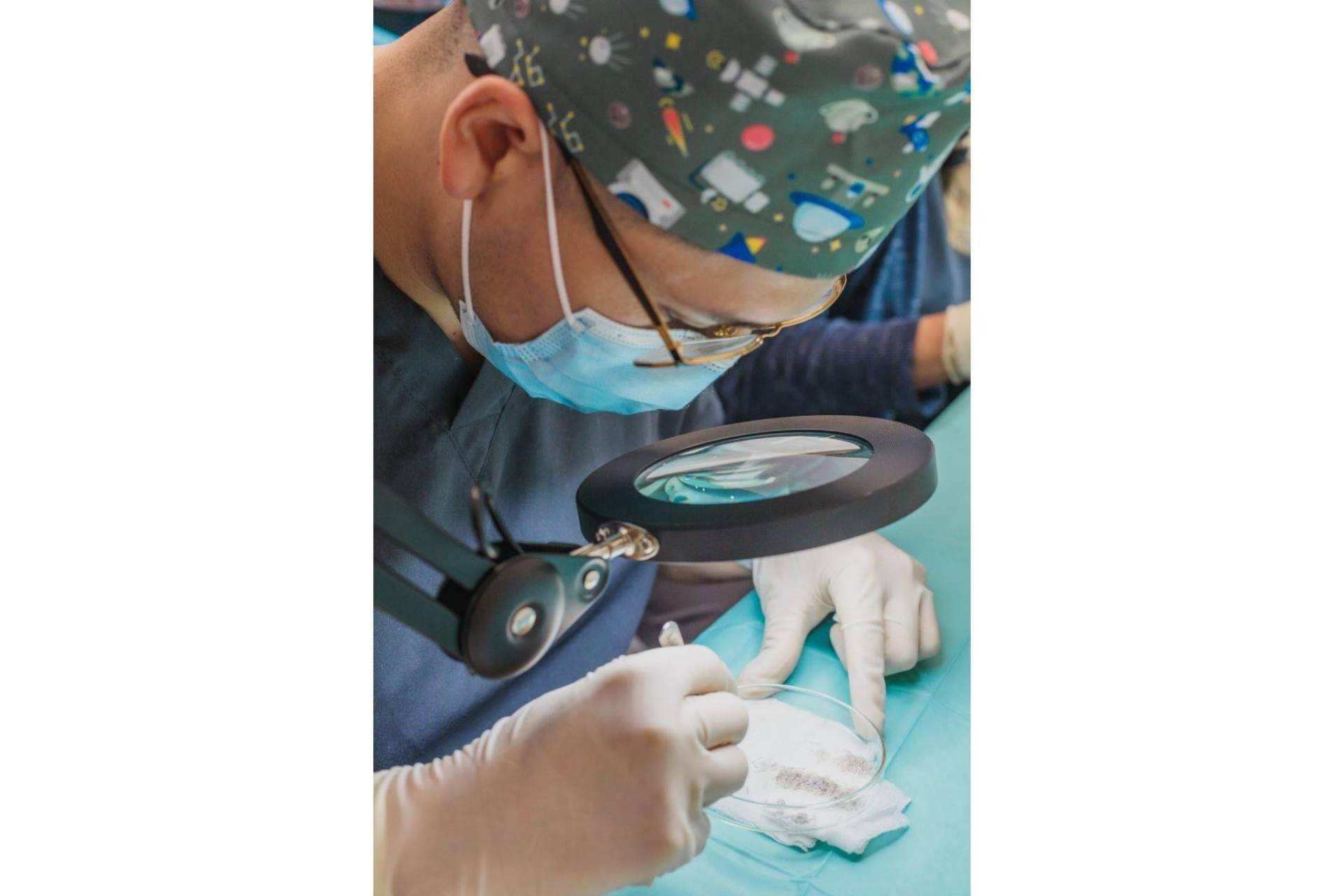 Microinjertos de barba y cejas de la mano de la Clínica Adcure